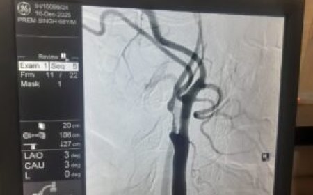 VELMED Hospital, Dehradun में स्ट्रोक से बचाव के लिए जटिल सर्जरी सफल