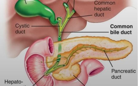 विश्व कैंसर दिवस पर श्री महंत इन्दिरेश अस्पताल ने चिकित्सा जगत में रचा इतिहास, “यूनाइटेड बाय यूनीक” थीम को साकार करती पित्ताशय कैंसर की अति-दुर्लभ सर्जरी, 11 घण्टे तक चली अत्यंत जटिल सर्जरी, 6 अंगों में फैली बीमारी को निकाला गया